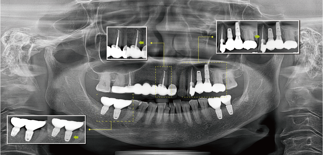 未標(biāo)題-3_畫板 1.png